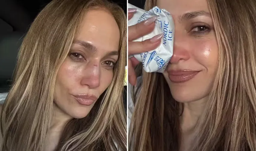 Foto: Reprodução | Instagram