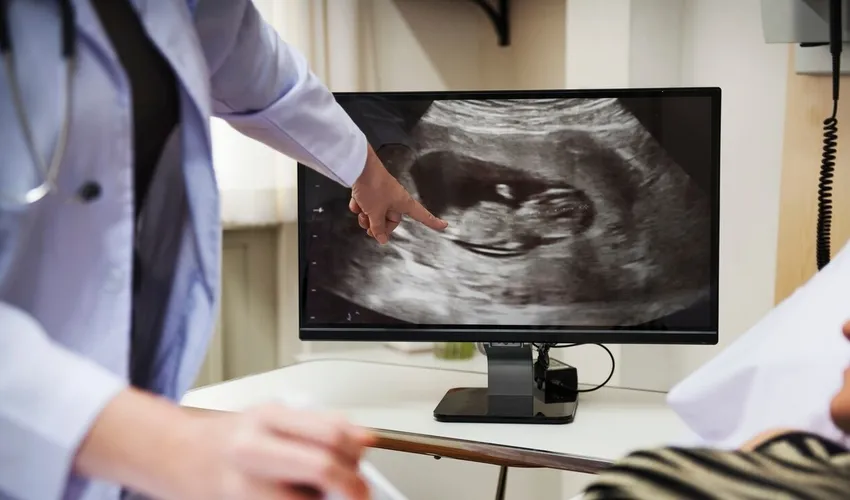 Foto: Lia Mara | Secom