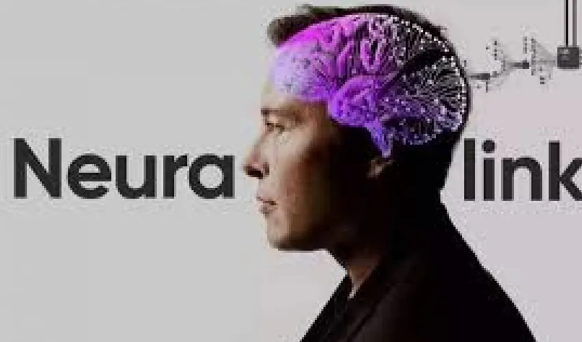 Foto: Neuralink | Divulgação